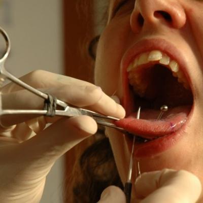 Bassanonet.it L'età indecente