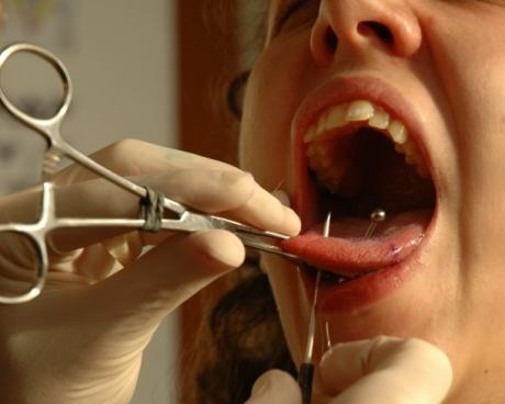 Bassanonet.it L'età indecente