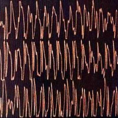 Bassanonet.it La musica nel cervello