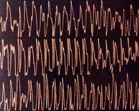 Bassanonet.it La musica nel cervello