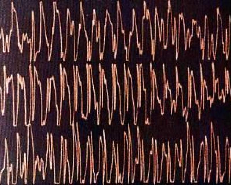 Bassanonet.it La musica nel cervello