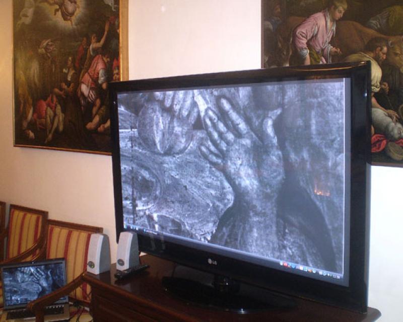 Bassanonet.it Jacopo Bassano, i raggi X e il cervello gonfiabile