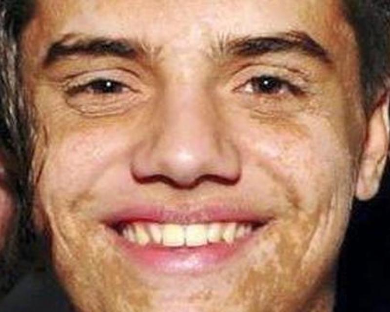 Bassanonet.it L'armatura di Alessio