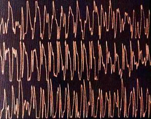 La musica nel cervello