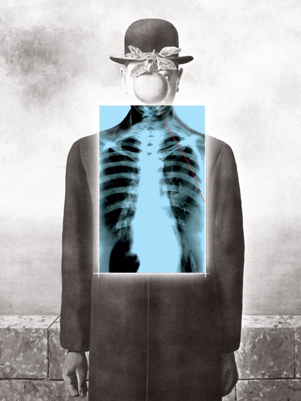 Grandi Maestri x-rays