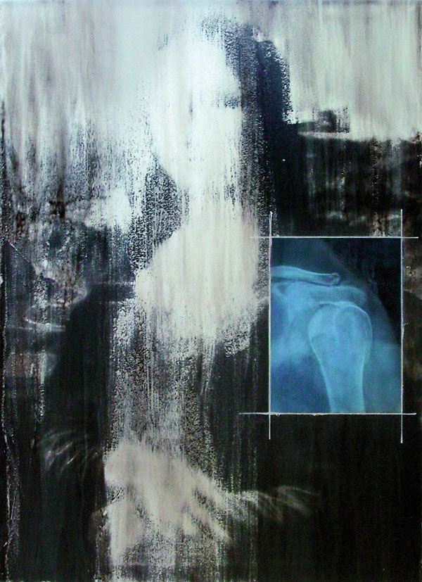 Grandi Maestri x-rays