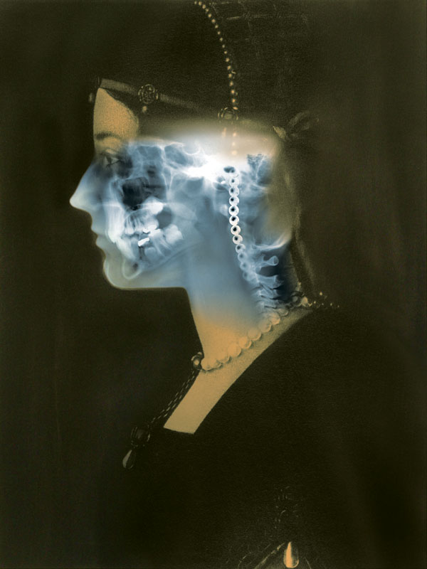 Grandi Maestri x-rays